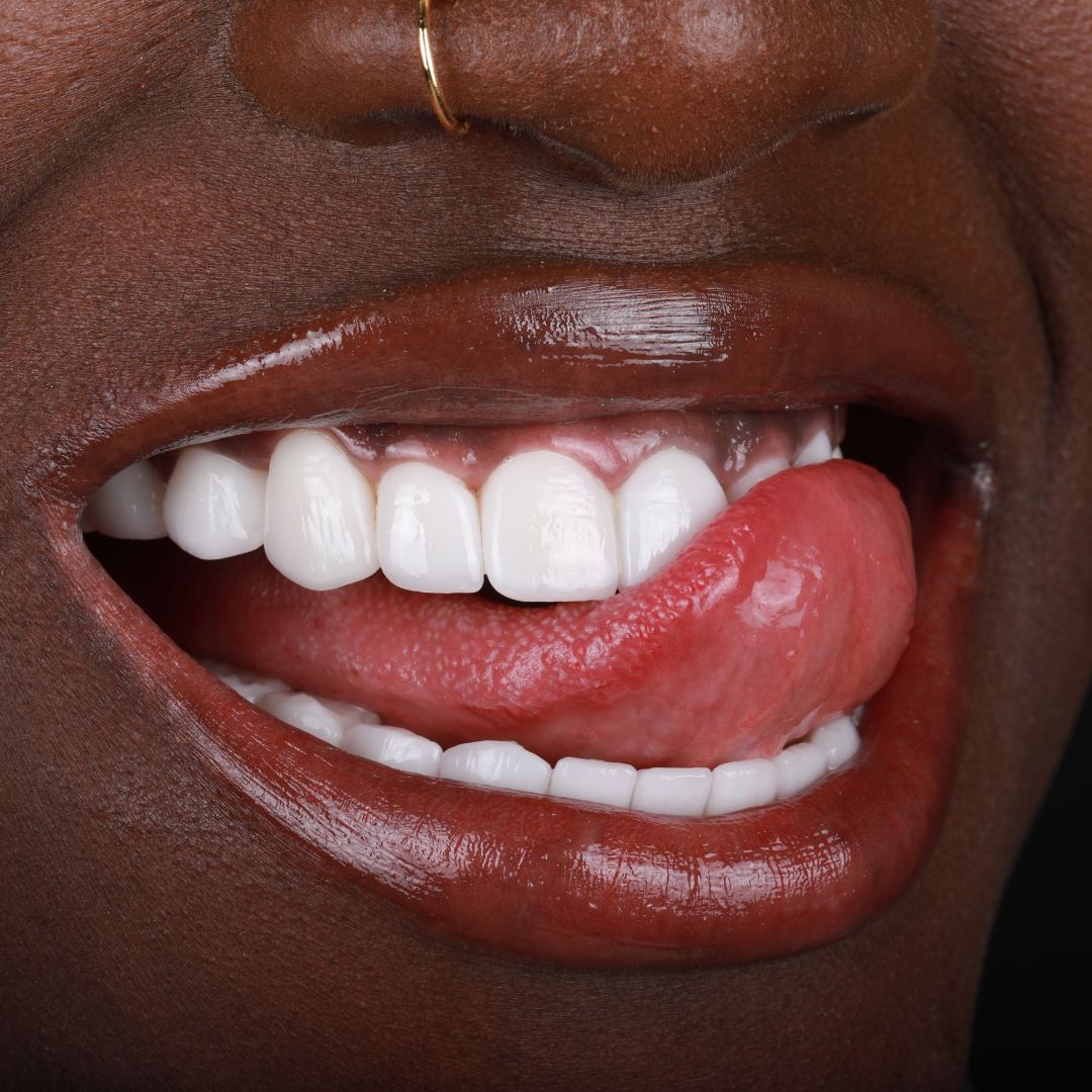 Purple Whitening Strips,