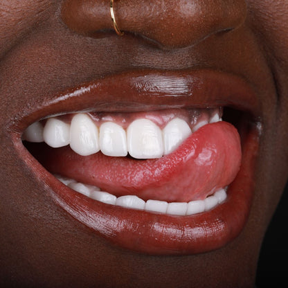 Purple Whitening Strips,